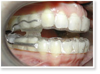 img_aparelho_oral_01