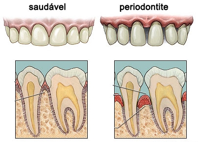 379b5e84bca13298534f6d29fe23ddef